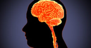 Atualiza25 | Neurorradiologia - Doenças Neurodegenerativas