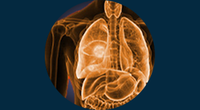 Atualiza26 | Oncologia - Erros em Radiologia Oncológica: Conhecendo para Evitá-los
